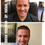 Botox, Xeomin & Dysport in Orange County: Which One is Right for You? 